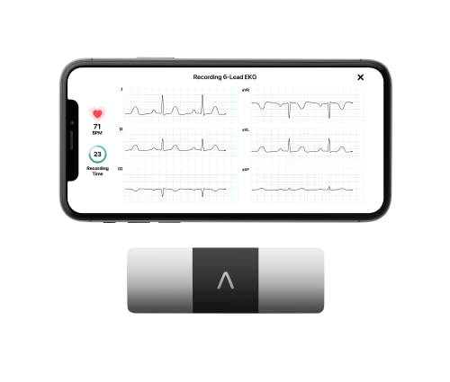 AliveCor KardiaMobile 6L Six-Lead EKG Monitor